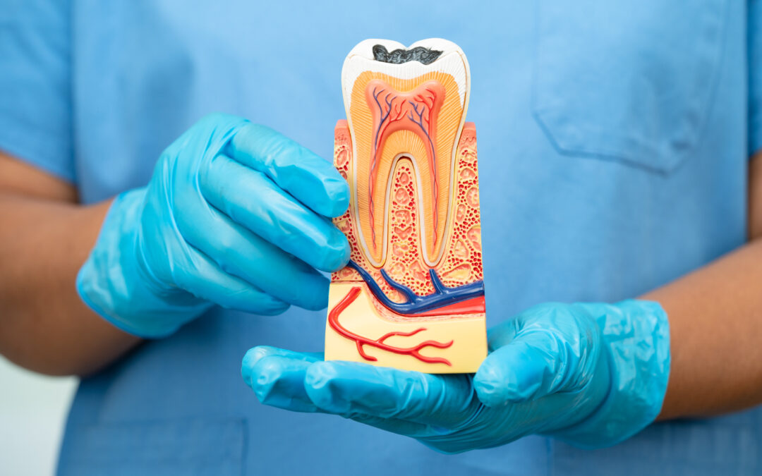 Root Canal Therapy: Gentle Care to Preserve Your Natural Tooth