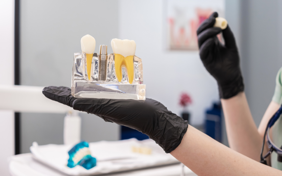 Dental Implant Gilbert