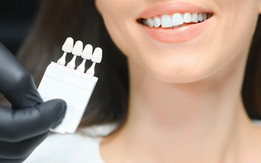 Thinking About Veneers? Read This If You Have Sensitive Teeth